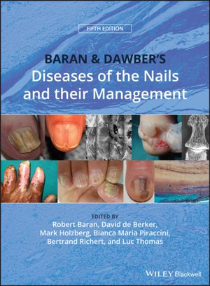Baran & Dawber′s Diseases of the Nails and their Management Fifth Edition