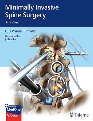 Tumialan, Minimally Invasive Spine Surgery, ePub