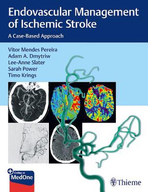 Pereira, Endovascular Management of Ischemic Stroke, ePub