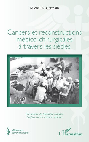 Cancers Et Reconstructions Medico-chirurgicales A Travers Les Siecles 