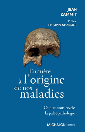 Enquete A L'origine De Nos Maladies : Ce Que Nous Revele La Paleopathologie 