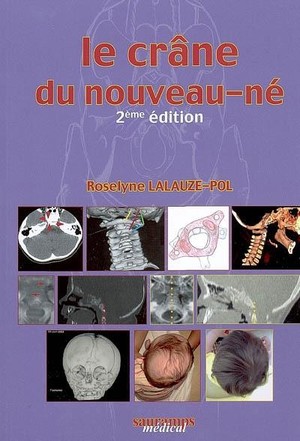 Le Crane Du Nouveau-ne (2e Edition) 