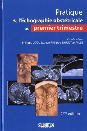 Echographie Obstetricale 1er Trimestre (2e Edition) 