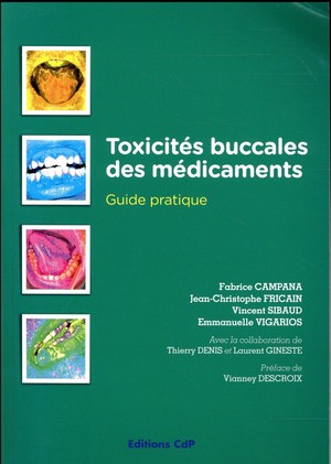 Toxicites Buccales Des Medicaments ; Guide Pratique 