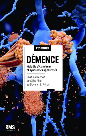 Demence : Maladie D'alzheimer Et Syndromes Apparentes 