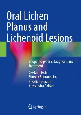 Oral Lichen Planus and Lichenoid Lesions