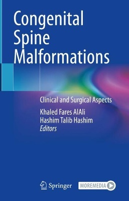 Congenital Spine Malformations