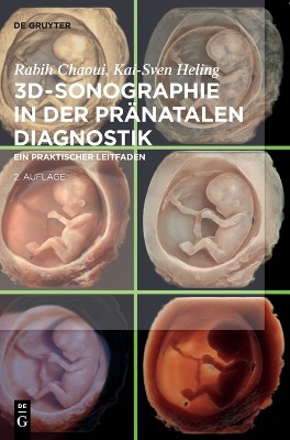 3d-Sonographie in Der Pr�natalen Diagnostik