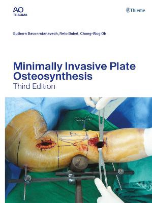 Minimally Invasive Plate Osteosynthesis