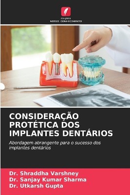 Considera��o Prot�tica DOS Implantes Dent�rios