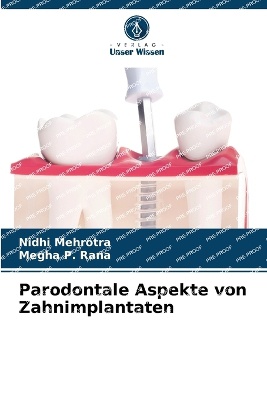 Parodontale Aspekte von Zahnimplantaten