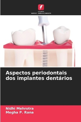Aspectos periodontais dos implantes dent�rios