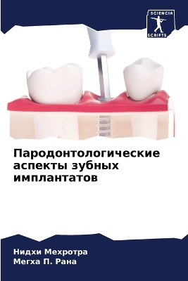 Пародонтологические аспекты зубных импл&