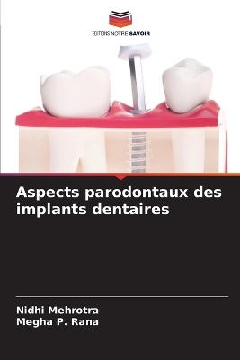 Aspects parodontaux des implants dentaires