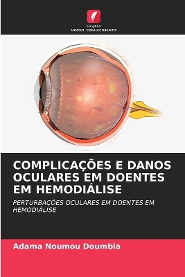 Complica��es E Danos Oculares Em Doentes Em Hemodi�lise
