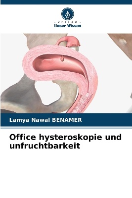 Office hysteroskopie und unfruchtbarkeit