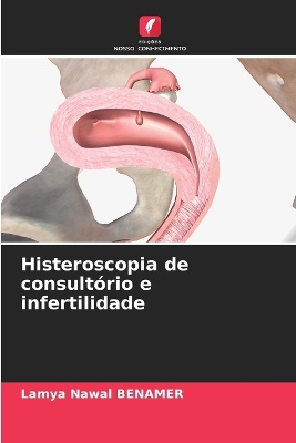 Histeroscopia de consult�rio e infertilidade