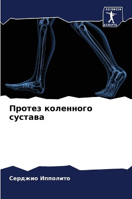 Протез коленного сустава