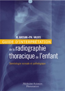 Guide D'interpretation De La Radiographie Thoracique De L'enfant : Semeiologie Normale Et Pathologique 