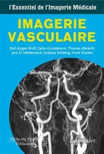 Imagerie Vasculaire 