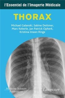 Thorax ; L'essentiel De L'imagerie Medicale 