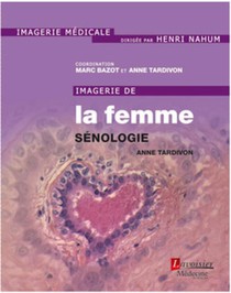Imagerie De La Femme : Senologie 