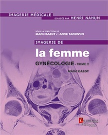 Imagerie De La Femme : Gynecologie Tome 2 