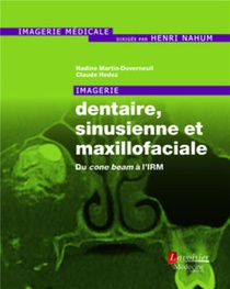 Imagerie Dentaire, Sinusienne Et Maxillofaciale ; Du Cone Beam A L'irm 