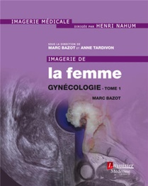 Imagerie De La Femme : Gynecologie 