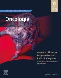 Imagerie Medicale : Oncologie 