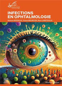 Infections En Ophtalmologie : Rapport Sfo 2024 