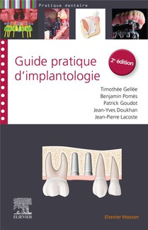 Guide Pratique D'implantologie (2e Edition) 