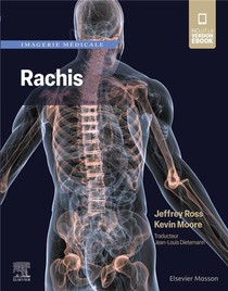 Imagerie Medicale : Rachis 