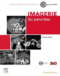 Imagerie Du Pancreas 