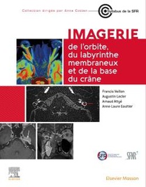 Imagerie De L'orbite, Du Labyrinthe Membraneux Et De La Base Du Crane 
