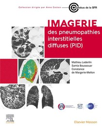 Imagerie Des Pneumopathies Interstitielles Diffuses (pid) 