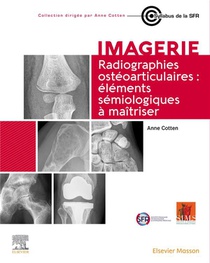 Imagerie : Radiographies Osteoarticulaires : Elements Semiologiques A Maitriser 