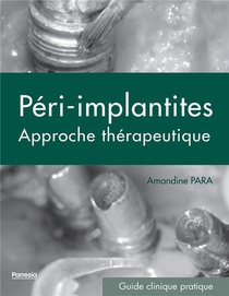 Peri-implantites ; Approche Therapeutique ; Guide Clinique Pratique 