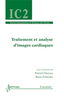 Traitement Et Analyse D'images Cardiaques ; Traite Ic2, Serie Information Et Science Du Vivan 