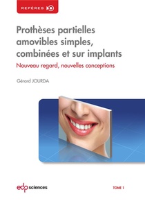Protheses Partielles Amovibles Simples, Combinees Et Sur Implants ; Nouveaux Regards, Nouvelles Conceptions 