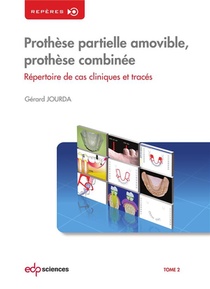 Prothese Partielle Amovible, Prothese Combinee ; Repertoire De Cas Cliniques Et Traces 