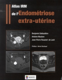 Atlas Irm De L'endometriose Extra-uterine 