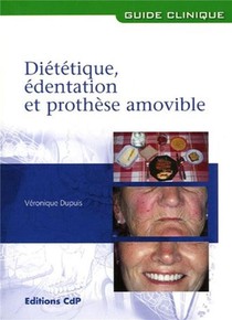 Dietetique, Edentation Et Prothese Amovible 