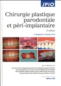Chirurgie Plastique Parodontale Et Peri-implantaire (3e Edition) 