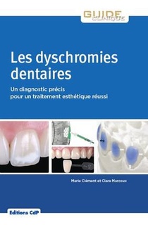 Les Dyschromies Dentaires ; Un Diagnostic Precis Pour Un Traitement Esthetique Reussi 