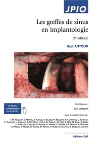 Les Greffes De Sinus En Implantologie (2e Edition) 