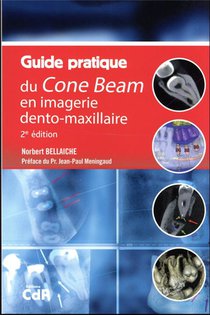 Guide Pratique Du Cone Beam En Imagerie Dento-maxillaire (2e Edition) 