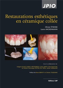 Restaurations Esthetiques En Ceramique Collee (2e Edition) 