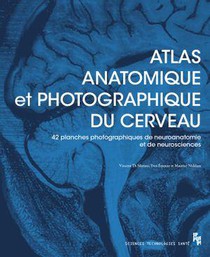 Atlas Anatomique Et Photographique Du Cerveau : 42 Planches (dont 41 Photographiques) De Neuroanatomie Et De Neurosciences 
