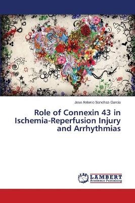 Role of Connexin 43 in Ischemia-Reperfusion Injury and Arrhythmias
